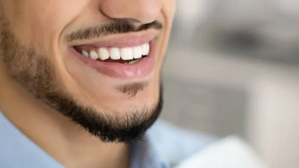 Sonrisa rehabilitada y sana después del tratamiento
