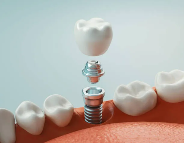 Escáner y equipamiento digital de la clínica dental